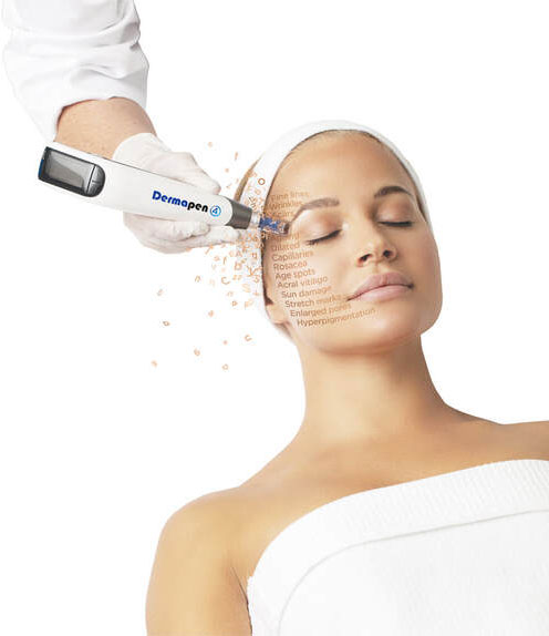 Dermapen4-ZoNaturelle3